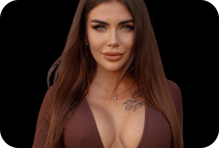After breast augmentation image showing fuller and natural-looking breasts